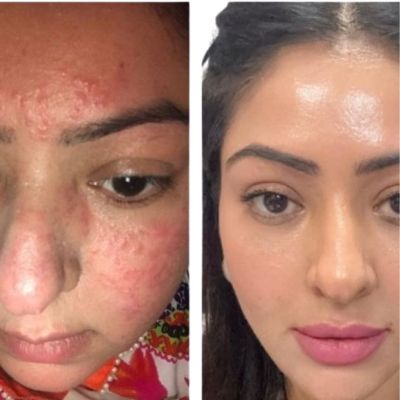 Before After