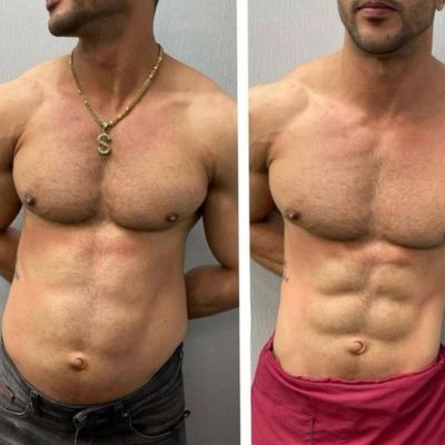 Before After