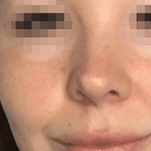 Before After
