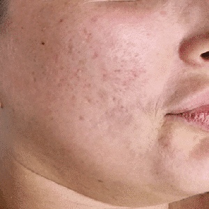 Before After