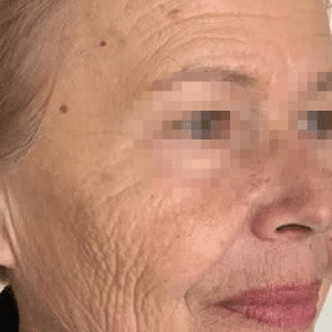 Before After