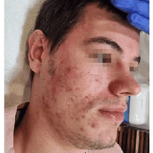 Before After