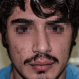 Before After