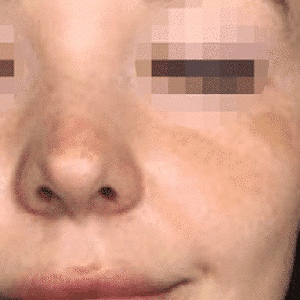 Before After