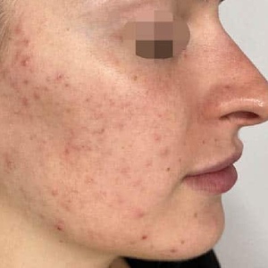 Before After