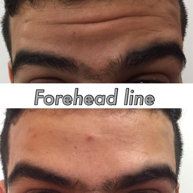 face 11
