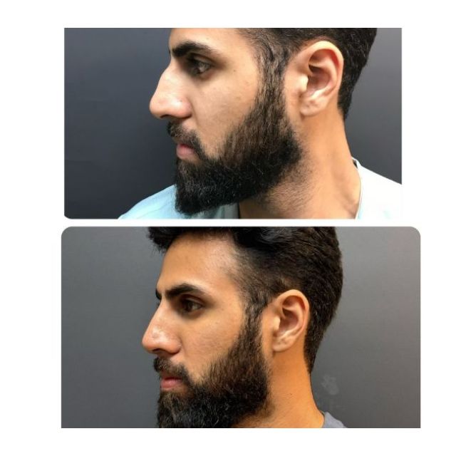 face 14