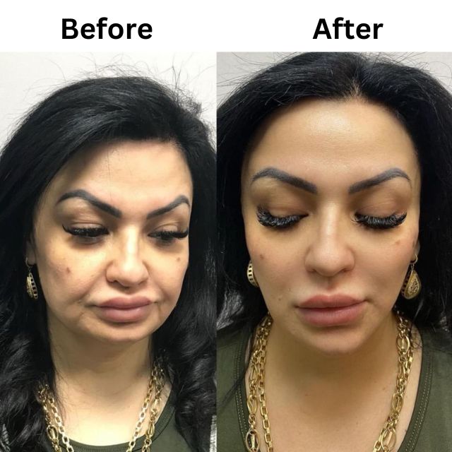 face 19