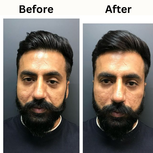 face 20
