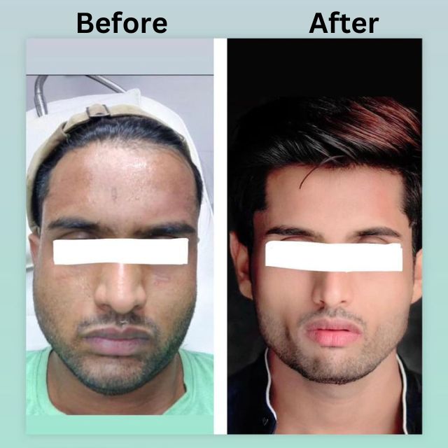 face 8
